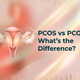 PCOS vs PCOD: What's the Difference?